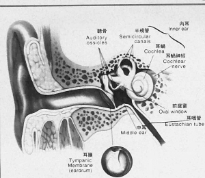 混合性耳聾