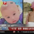 萎縮嬰兒