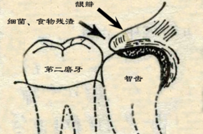 盡根牙