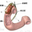 順行式膽囊切除術