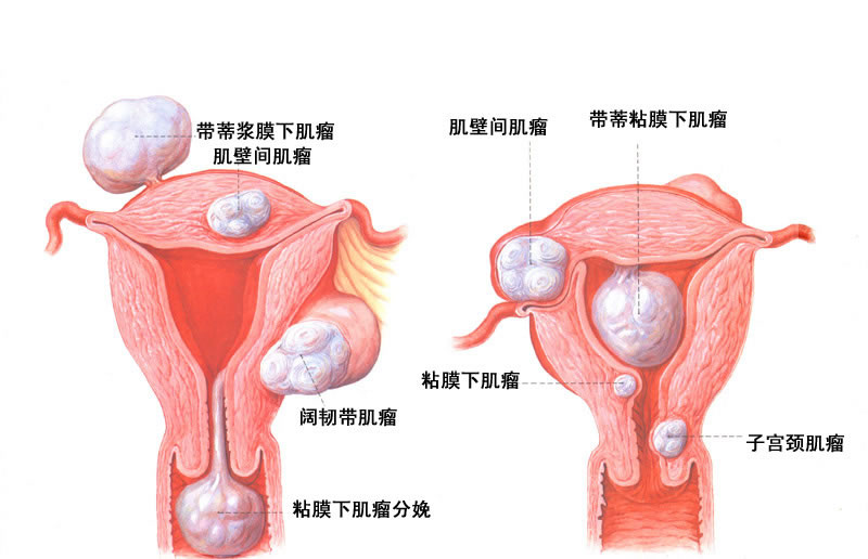 陰道不規則出血