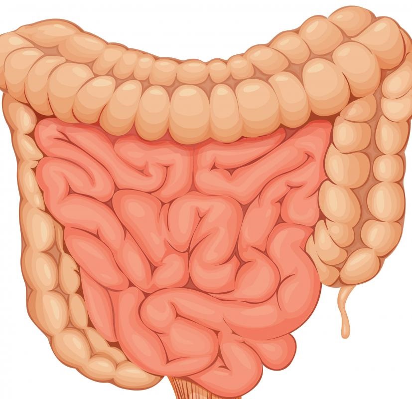 腸腫瘤