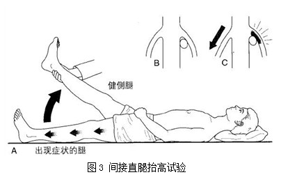 腰椎間盤突出症康復