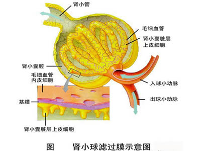 微小病變性腎病