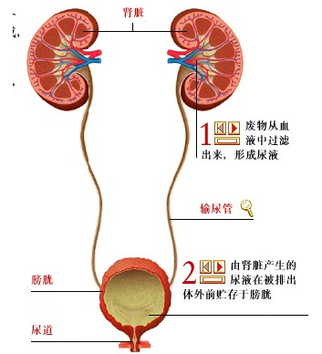 高鈣尿