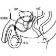 前列腺縮小變硬