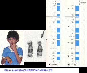 染色體畸變