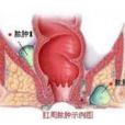 肛門會陰區潮濕不潔