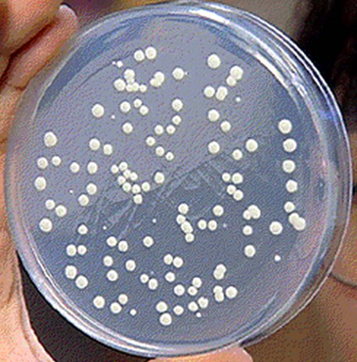 用於分離微生物的固體培養基