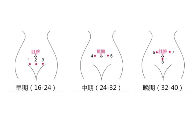 遠程胎心監護系統