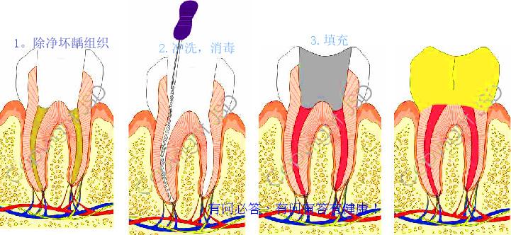 糖(碳水化合物)