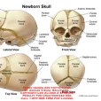 新生兒顱骨