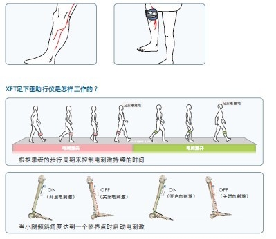 XFT-2001足下垂助行儀