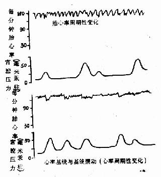 高危妊娠