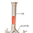 氣管切除術