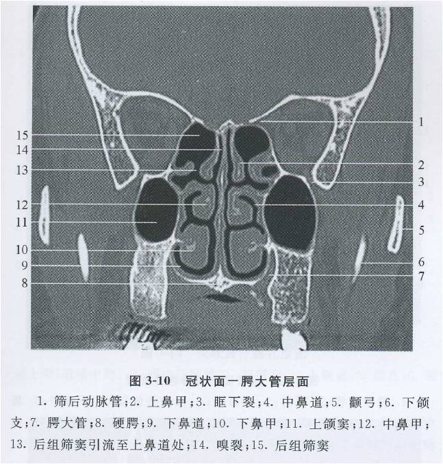 嗅裂