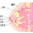 乳腺炎疾病