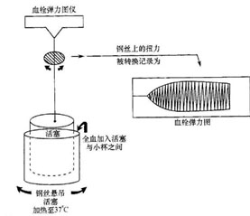 圖1 血栓彈力圖儀裝置圖