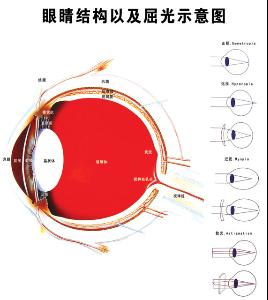 弱視眼