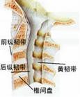 腰椎管狹窄