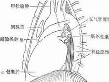 囊腫壁薄且內含無色液體