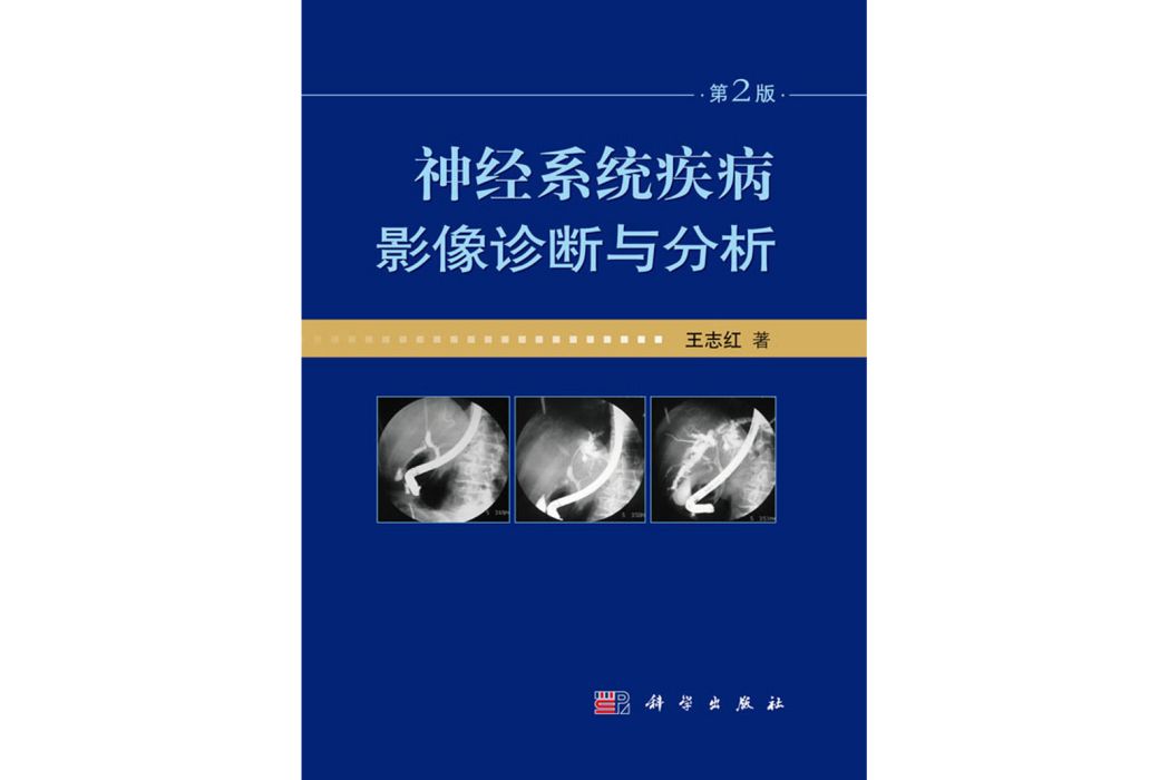 神經系統疾病影像診斷與分析(2017年科學出版社出版的圖書)