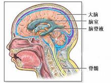 顱神經損害