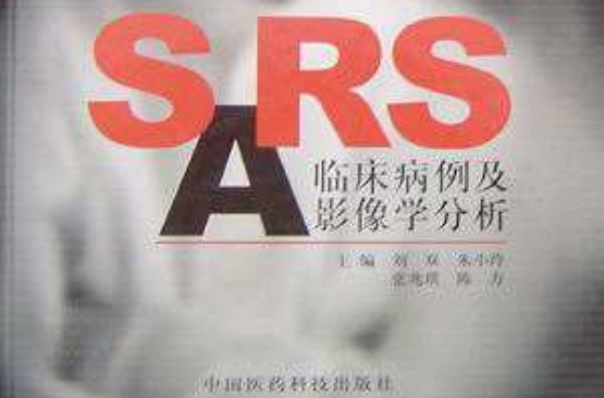 SARS臨床病例及影像學分析