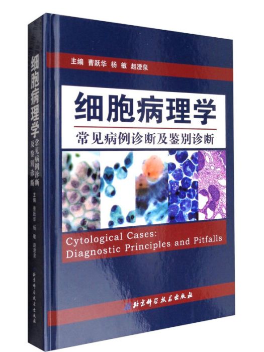 細胞病理學常見病例診斷及鑑別診斷(曹躍華、楊敏、趙澄泉所著書籍)