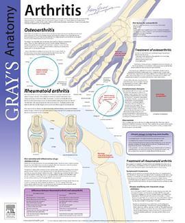 Arthritis(Dickson FRCP(Glas) FRCP(Lond) MRCGP, D. John著圖書)