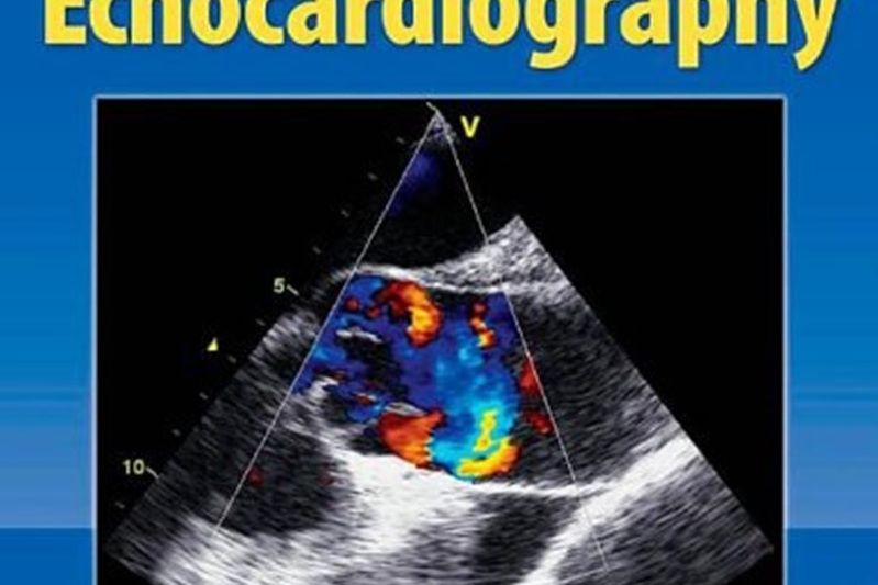 Complete Guide to Echocardiography