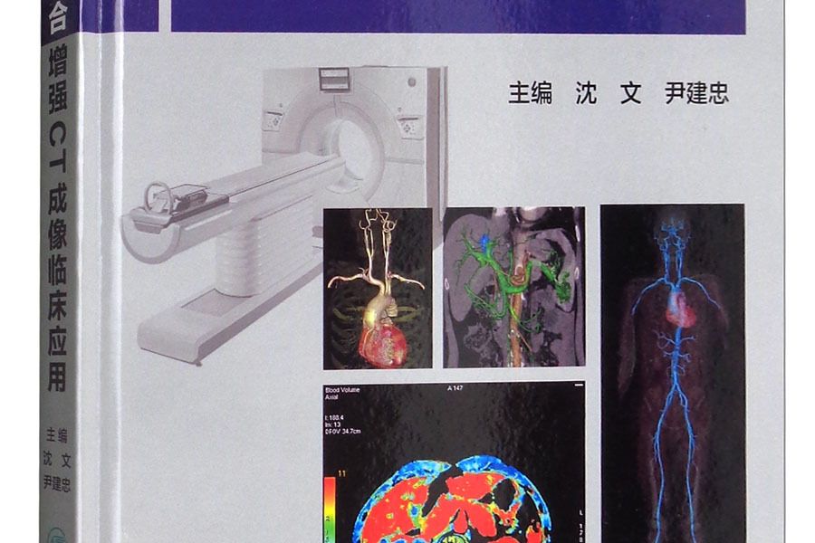 多部位聯合增強CT成像臨床套用