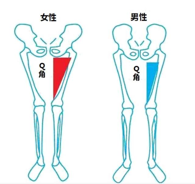 Q角大，不利於運動。