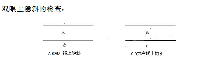 隱斜計