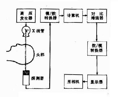 CT成像基本原理