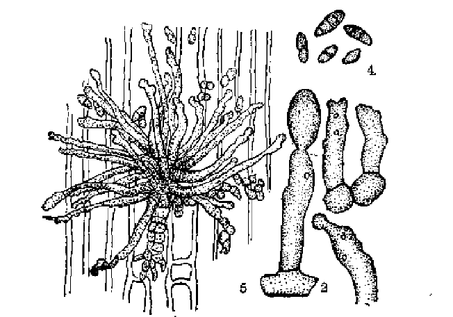 芽孢狀枝孢霉