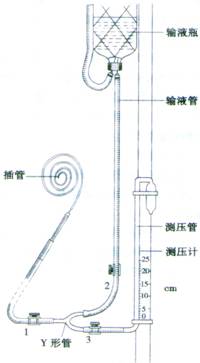 中心靜脈壓測定&amp;amp