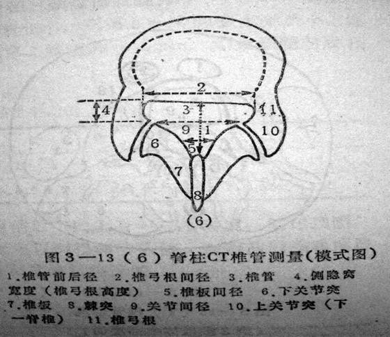 側隱窩