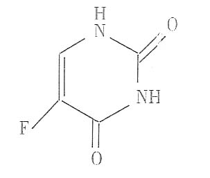 氟尿嘧啶植入劑