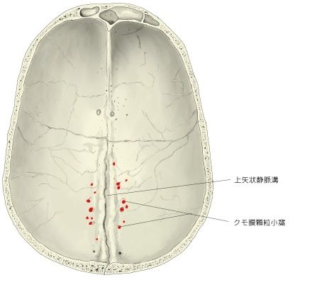 顆粒小凹