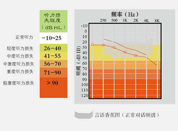 聽力損失