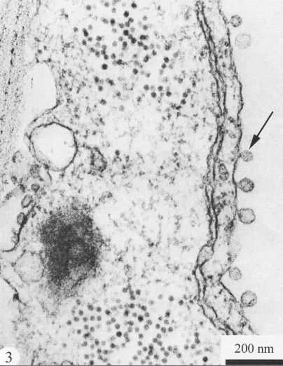 菸草壞死病毒