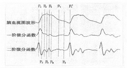 圖2  腦血流圖波形識別方法