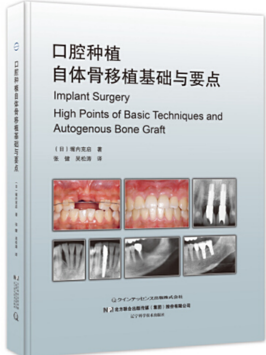 口腔種植自體骨移植基礎與要點