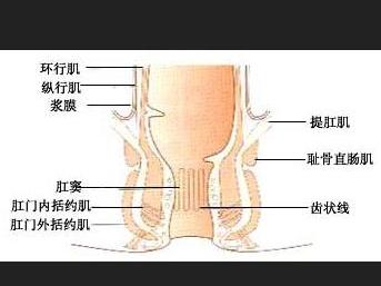 肛門外括約肌斷裂