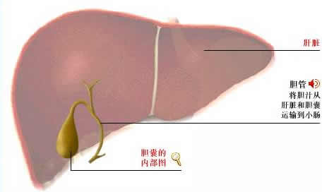 肝硬化結節影像特點