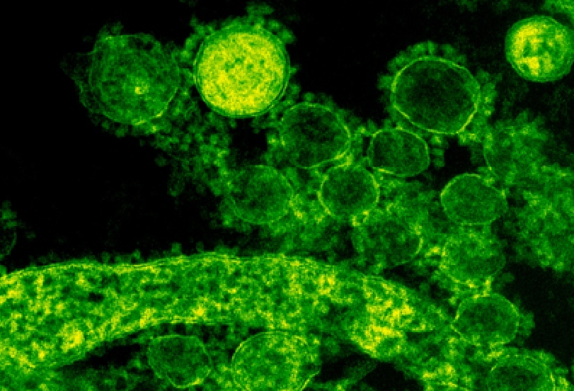 中東呼吸系統綜合徵冠狀病毒