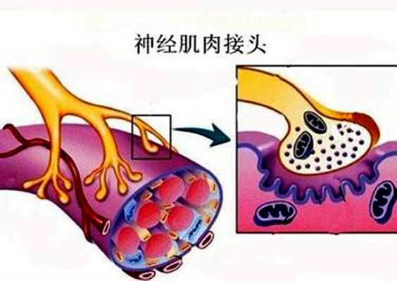 神經肌肉接頭疾病