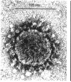 電鏡下的SARS病毒