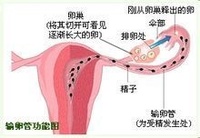 子宮輸卵管不通